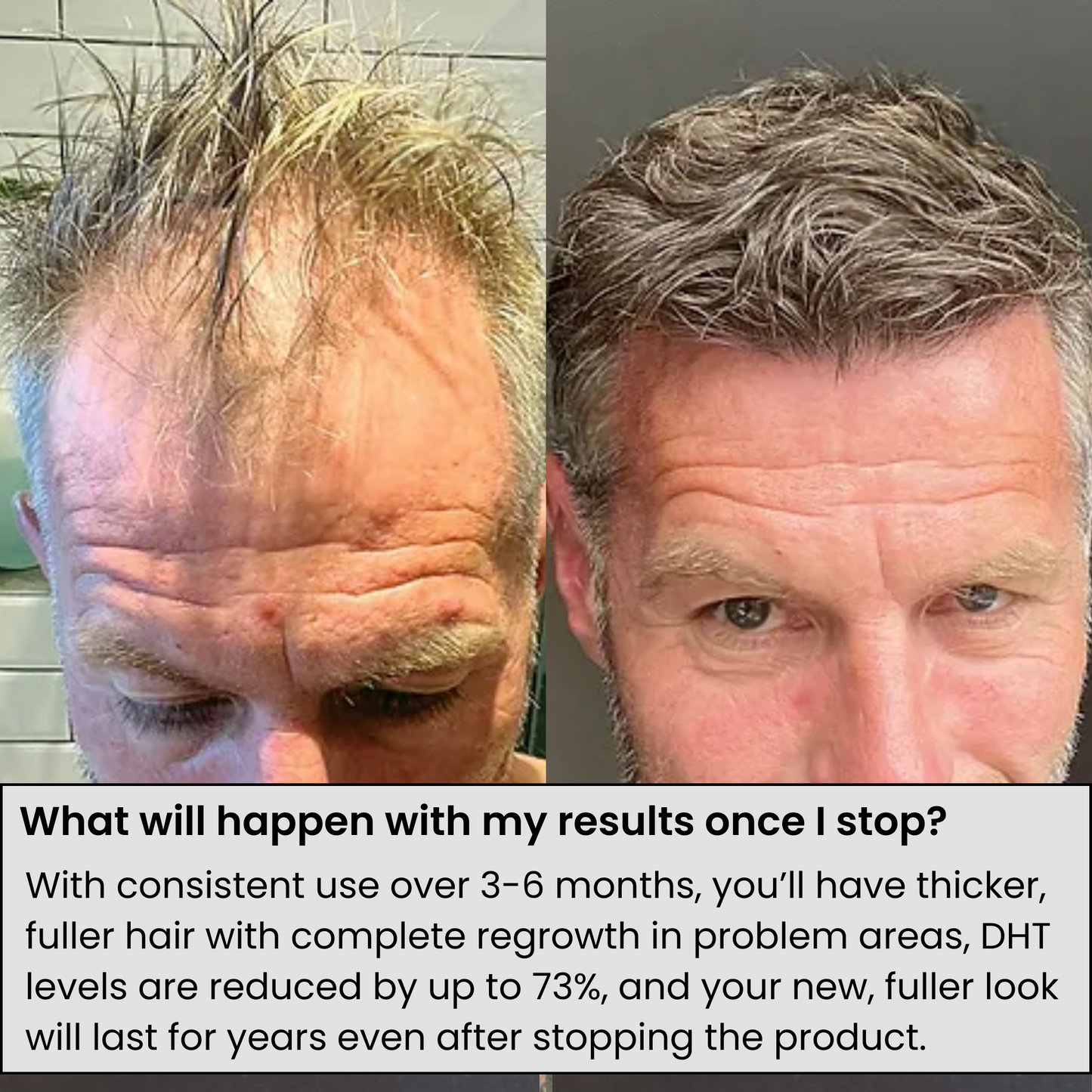 Nestura™ Hair Regrowth Serum